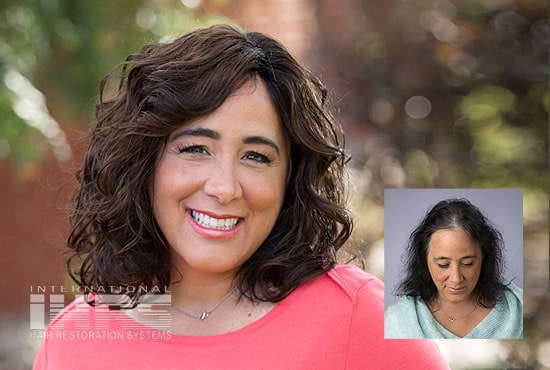 Women's Hair Replacement - Jacksonville, FL