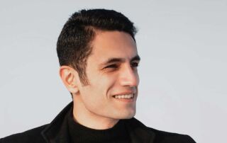 Scalp micropigmentation for thinning hair