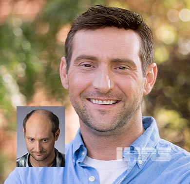 mens-hairpieces-jacksonville-florida A man with dark hair and a light beard smiles outdoors. An inset in the lower left shows him before Men's Hair Loss Restoration in Jacksonville, FL, with noticeably thinning hair on top, highlighting his remarkable transformation.